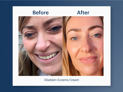 Skin Journey: Nicola Green