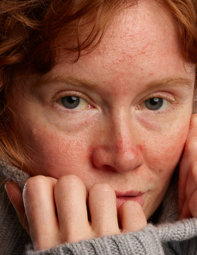 ROSACEAR Gel ROSACEAR Gel