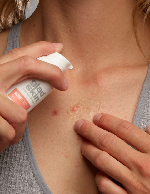 ACNEFEKT Gel ACNEFEKT Gel