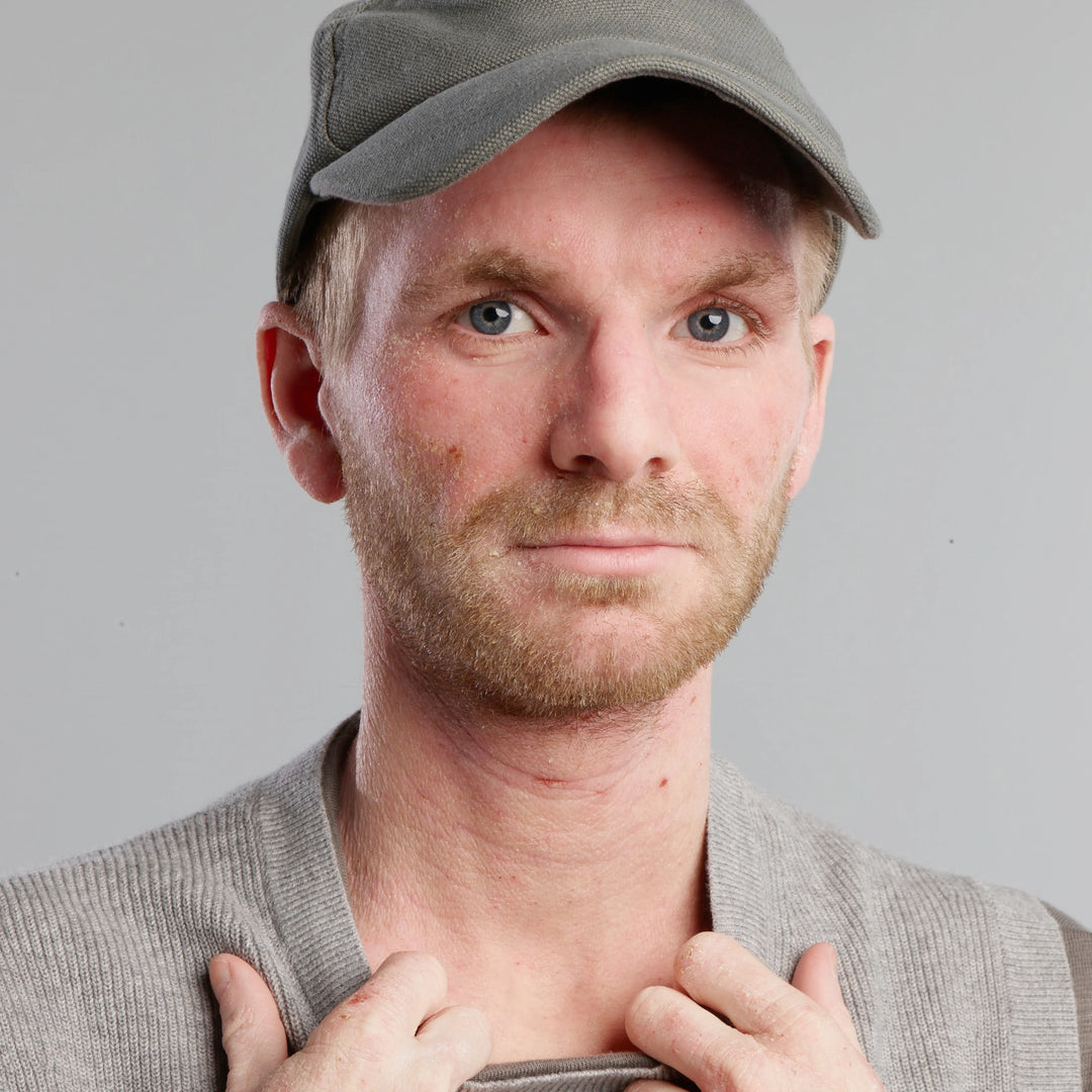 Man with eczema on face