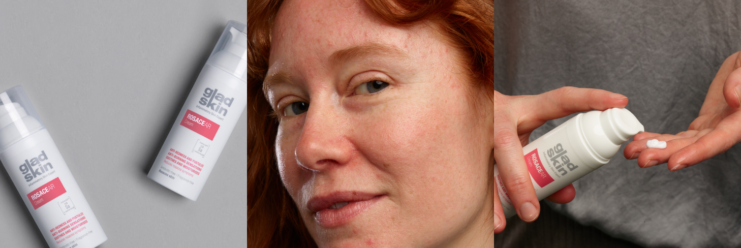 Rosacea + Eye Health: What’s the Connection?