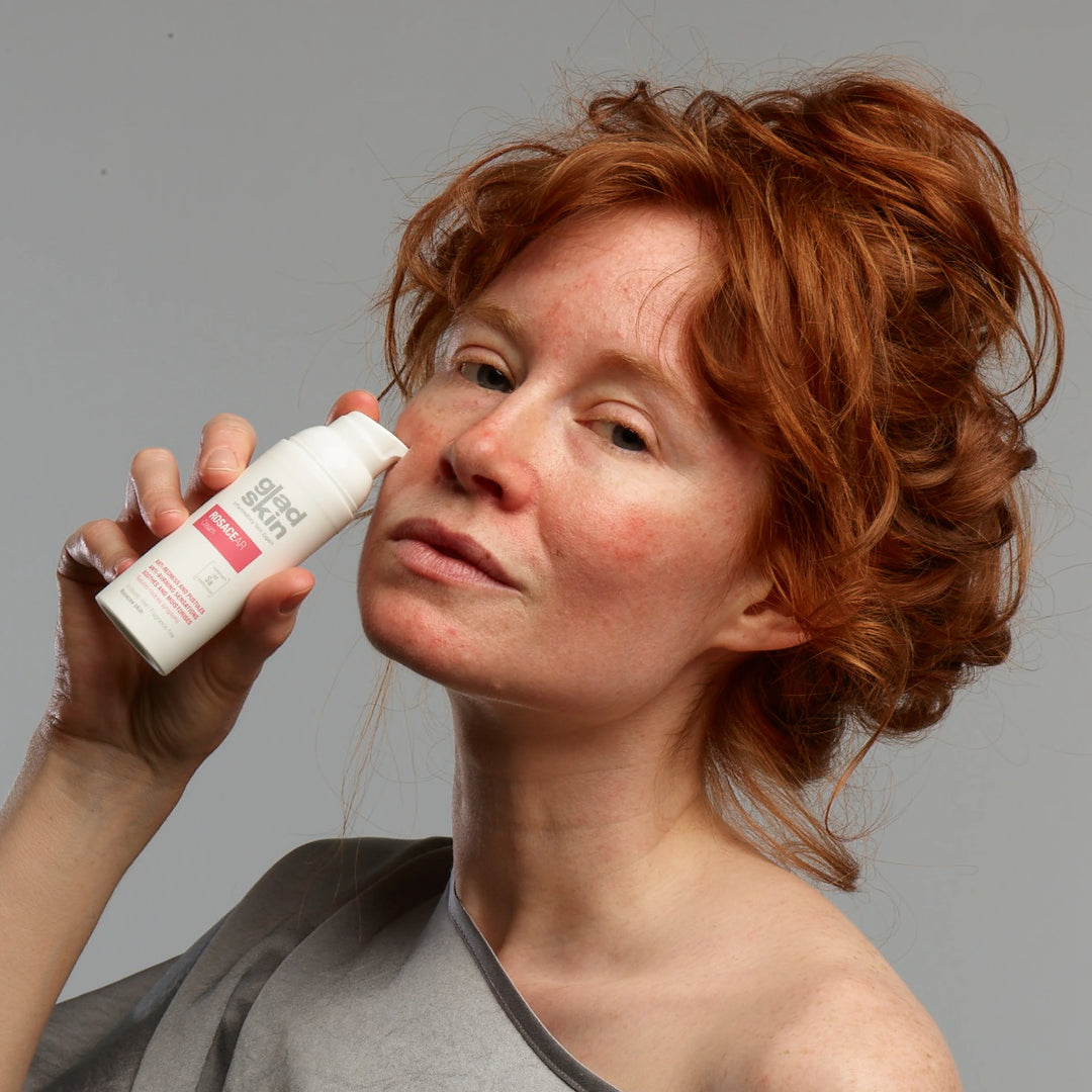 Lady affected by rosacea on the face, holding a Rosacear cream