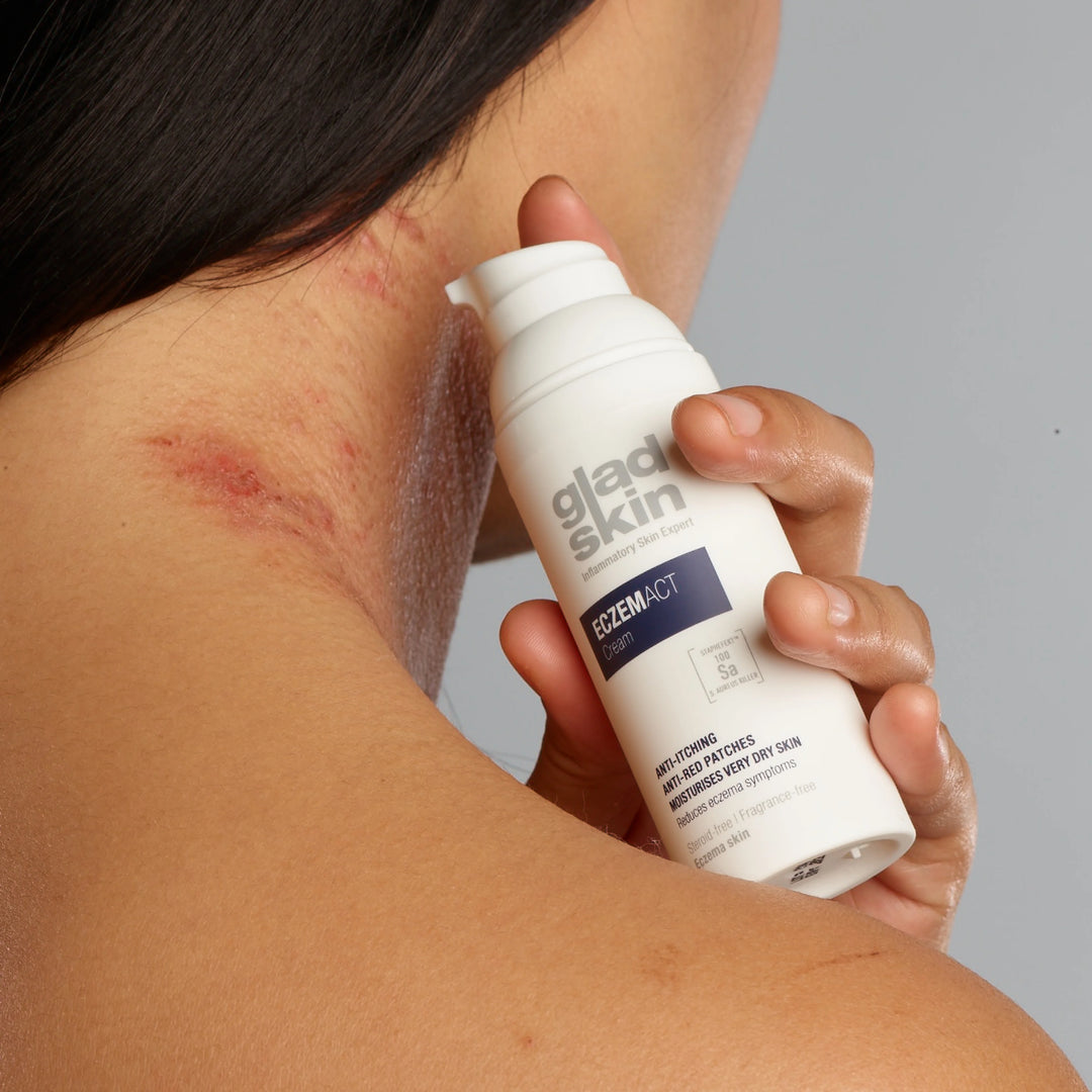 Eczemact Cream application on lady's neck