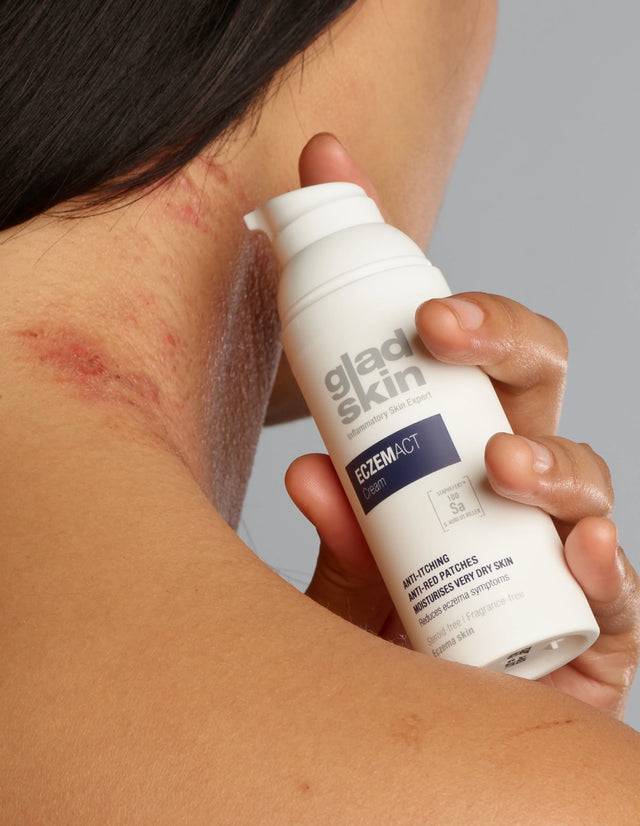 ECZEMACT Cream is a medical device that contains Staphefekt and reduces eczema symptoms in few days