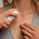 Acnefekt Gel application on lady's chest