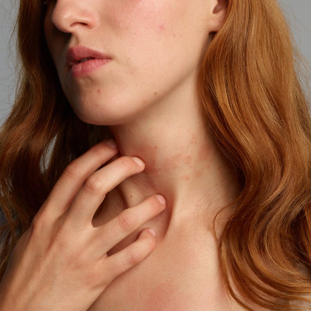 Lady with blemishes on the neck