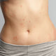 Body of a lady with inflammatory conditions